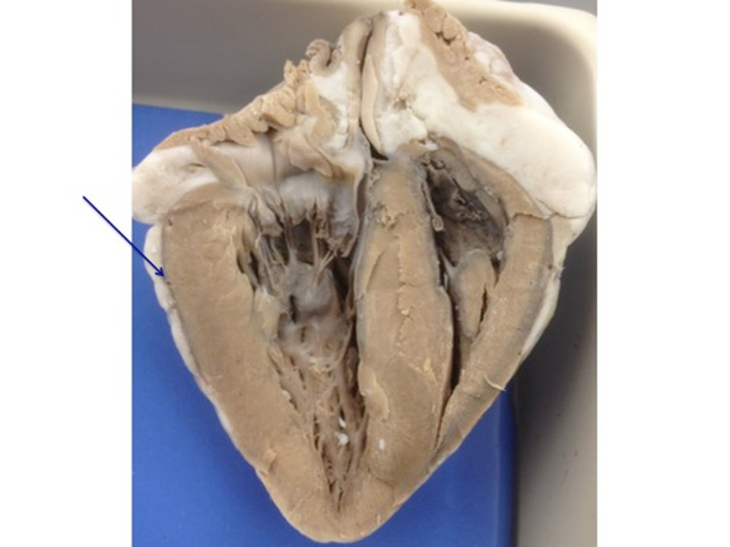 <p>Membrane surrounding the heart</p>