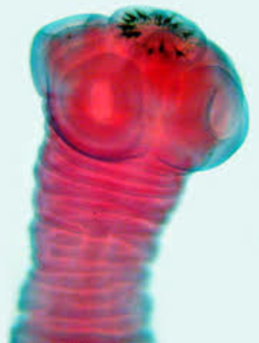 <p>parasite that lives inside its host</p>