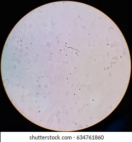 <p>What magnification level are the Sperm Cells? </p>