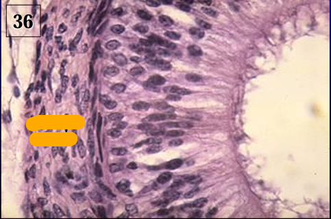<p>Identify the structure:</p><p>Specie:</p><p>Orange:</p><p>Lined by:</p>
