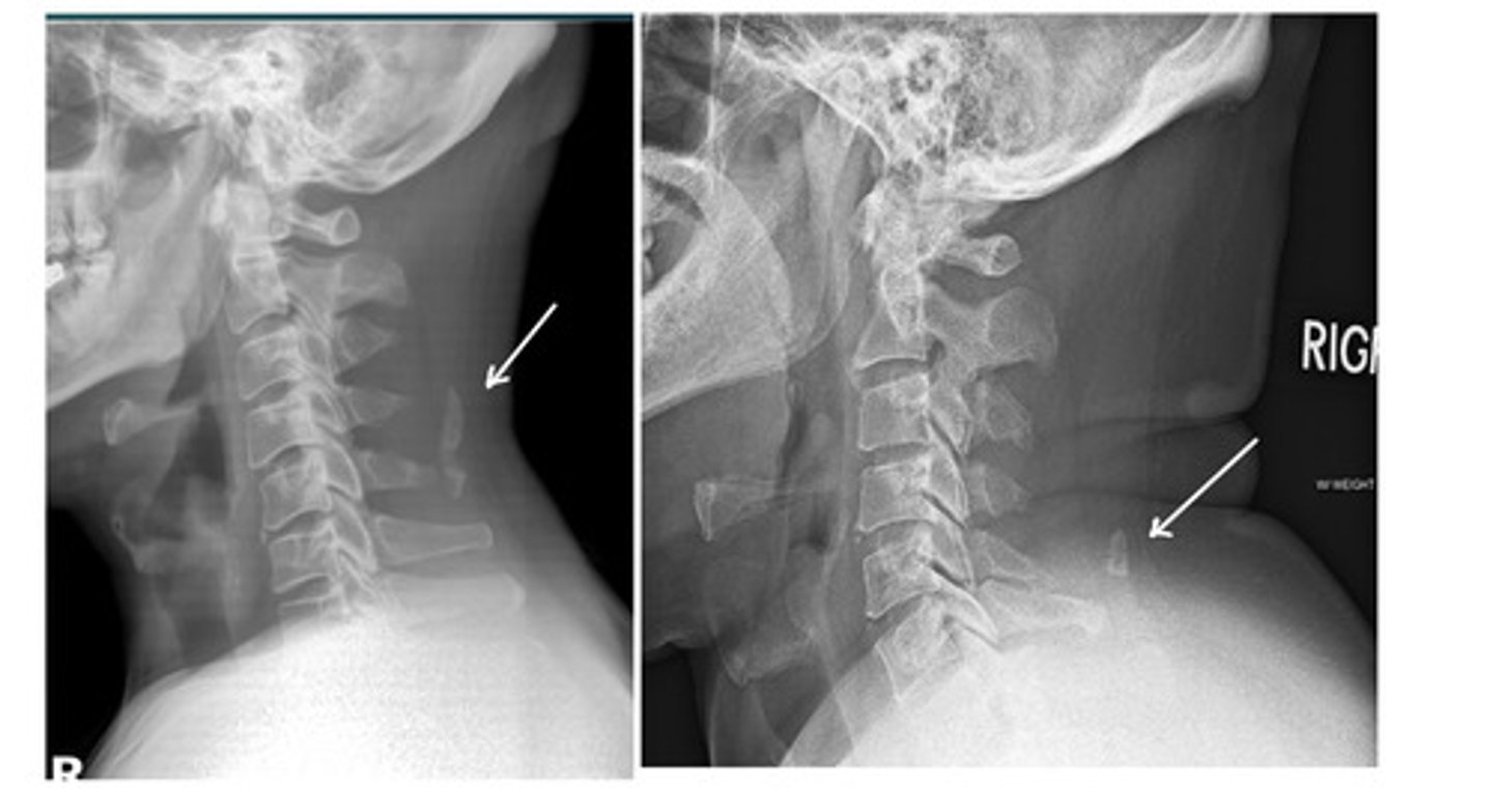 <p>What are we looking at here?</p>