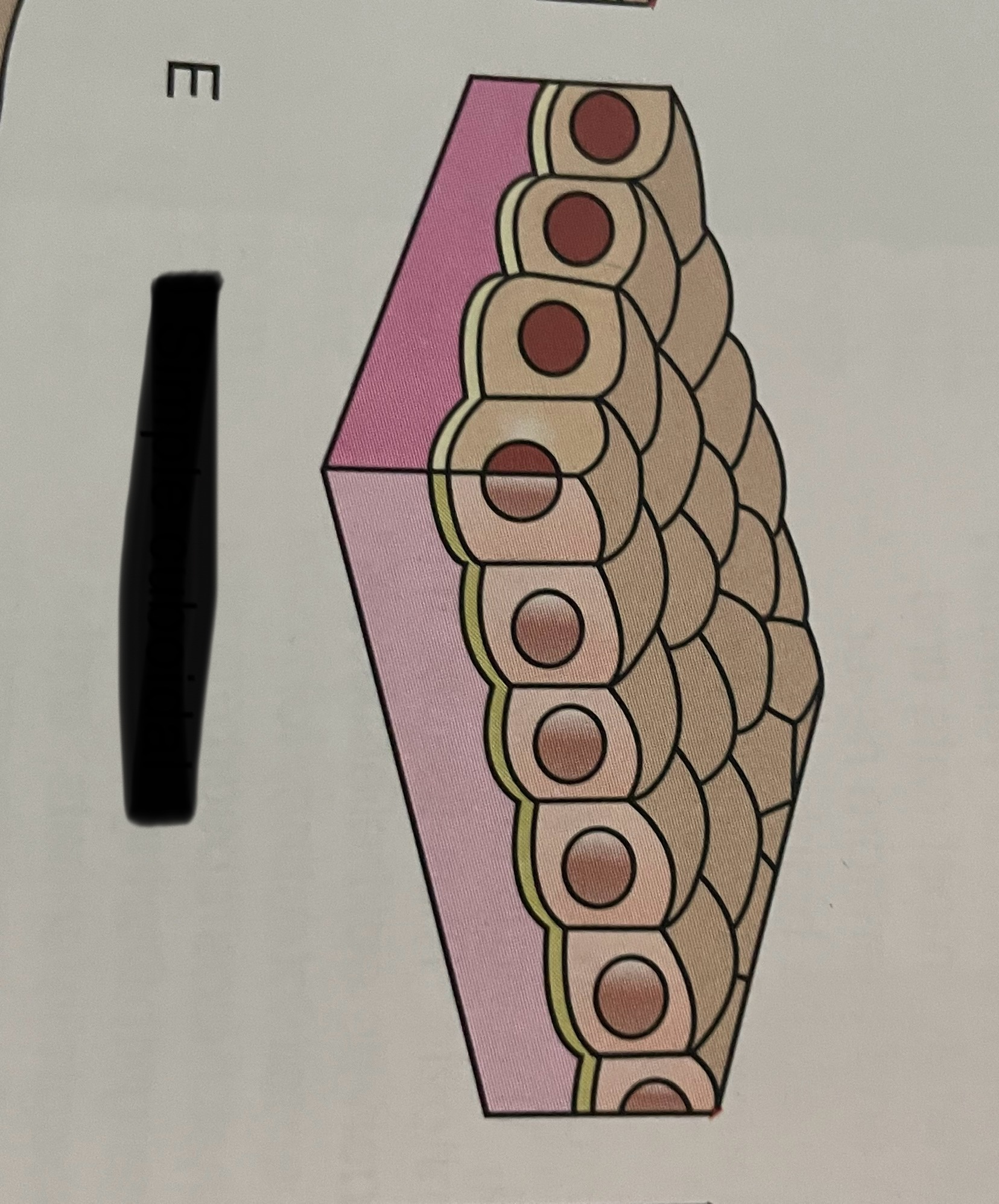 <p>what type of layering is this?</p>