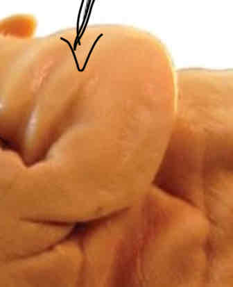 <p>Identify this structure</p>