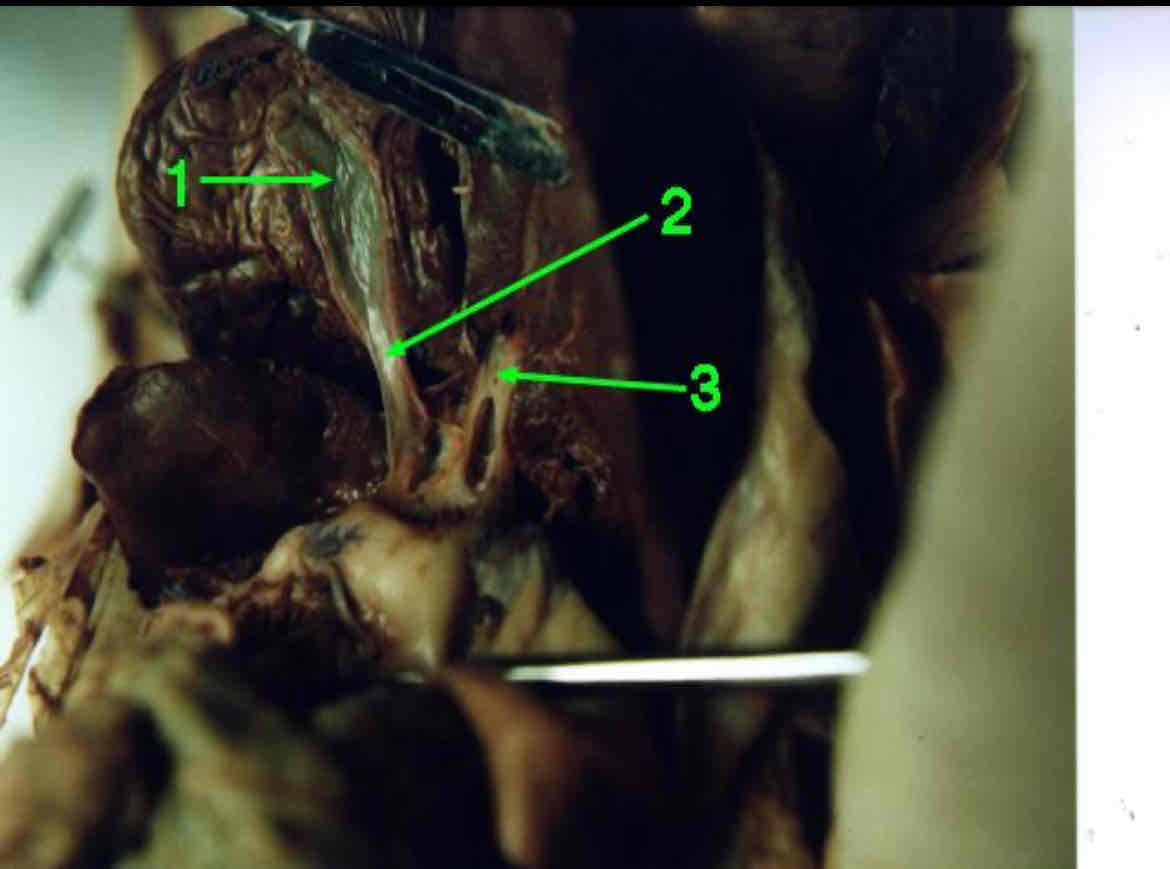 <p>Identify this structure (#1)</p>
