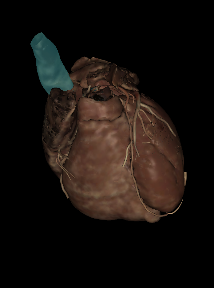 <p>Name the structure highlighted </p>