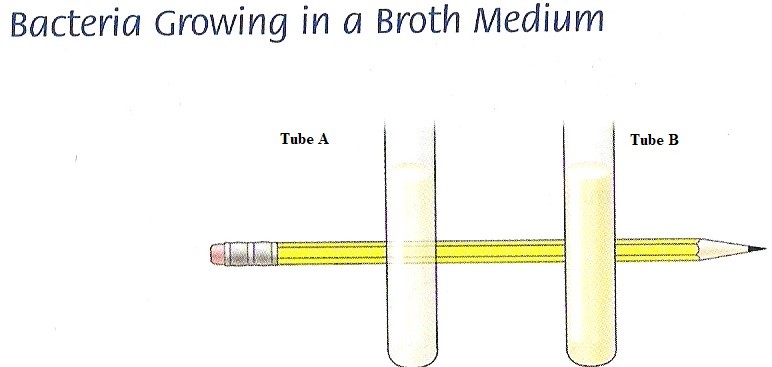 <p>describe the broth culture in tube B in this picture:</p><p>a. turbid</p><p>b. sedimented </p><p>c. has a pellicle </p><p>d. pigmented </p>