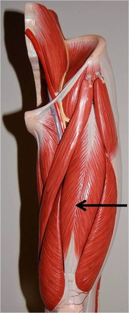 <p>Origin: Anterior inferior iliac spine and supracetabular groove of the ilium<br>Insertion: Tibial tuberosity (via patellar ligament)<br>Action: Flex the thigh and extend the leg</p>