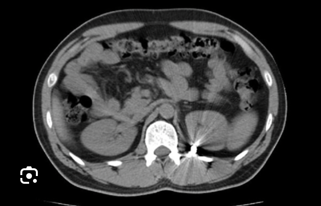 <p>Which CT view?</p>