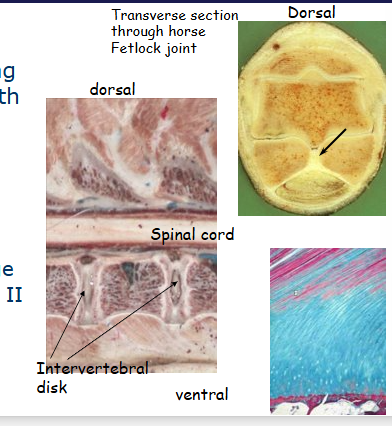 <p>white fibrocartilage</p><ul><li><p>found in areas requiring tough support/great tensile strength e.g. intervertebral disks, symphyses</p></li><li><p>lines surface of bony grooves for tendons - flexor digital sheath, palmar surface of navicular bone</p></li><li><p>interface ligament/tendon and bone</p></li><li><p>contains more collagen than hyaline cartilage</p></li><li><p>contains type 1 and 2</p></li><li><p>lacks a perichondrium</p></li></ul><p></p>