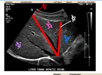 <p>Identify the outlined structures &nbsp;</p>