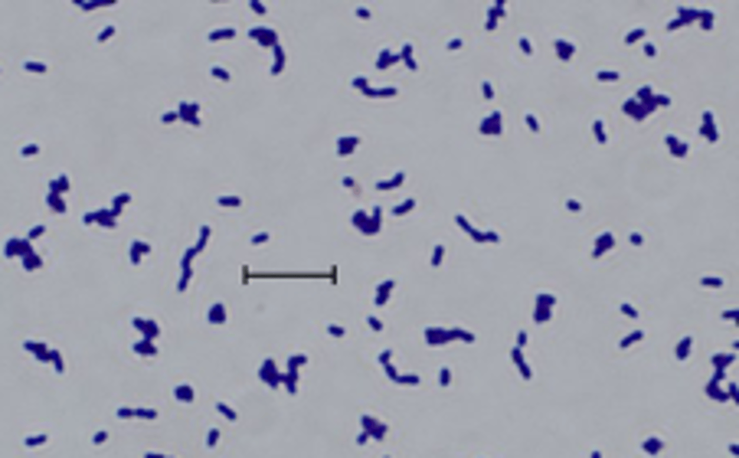 <p>what causative agent of liver abscesses is indicated in this image</p>