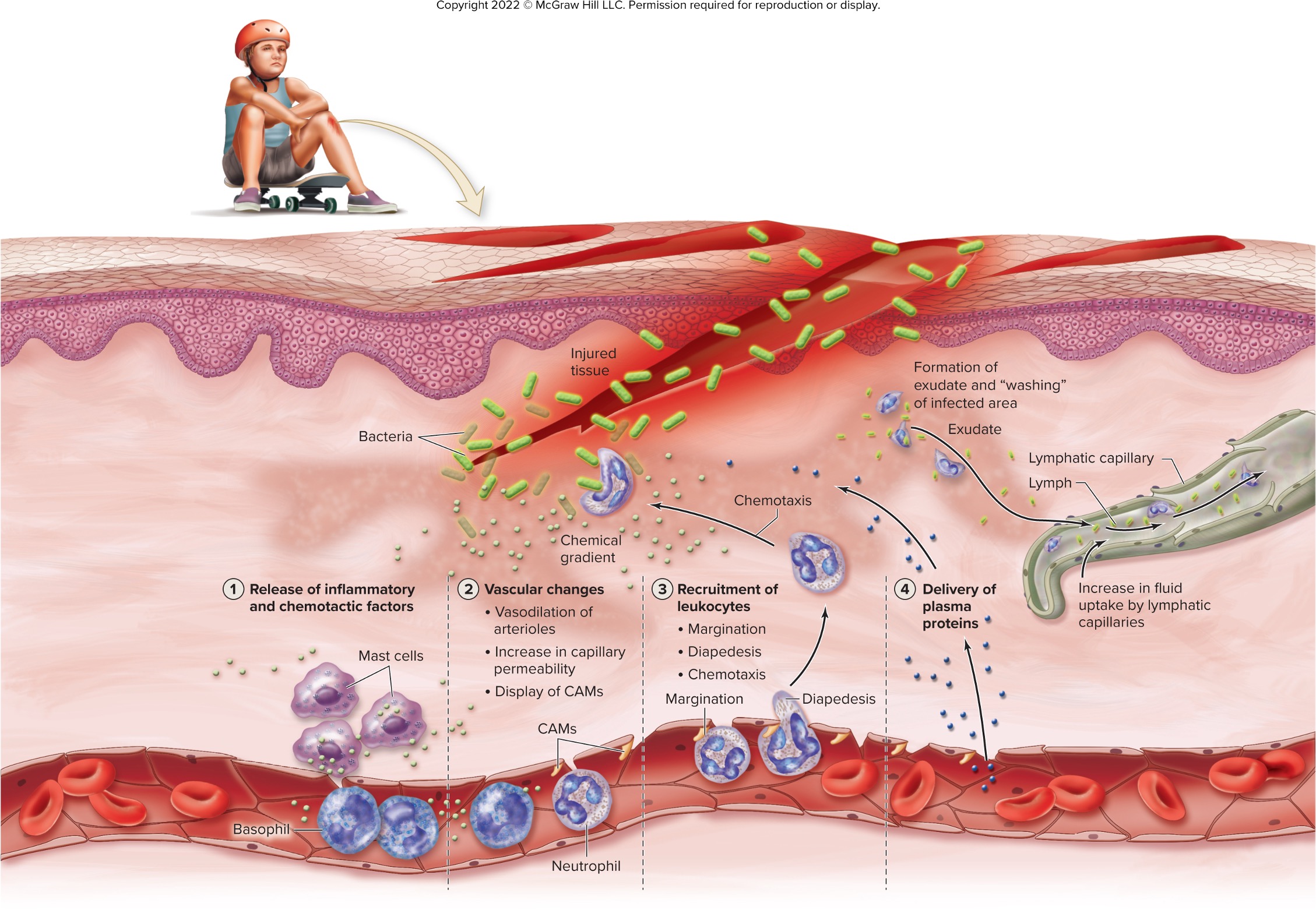 <p>leukocytes migrate toward chemicals released from damaged dead, or pathogenic cells</p>
