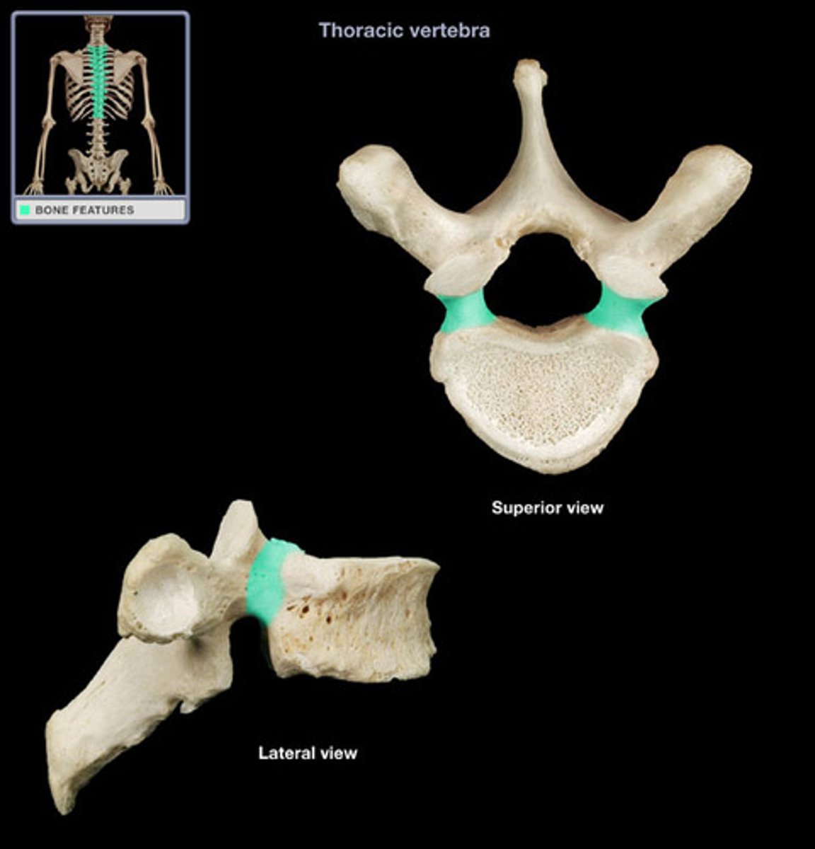 <p>posterior projection from vertebral body that supports the lamina</p>