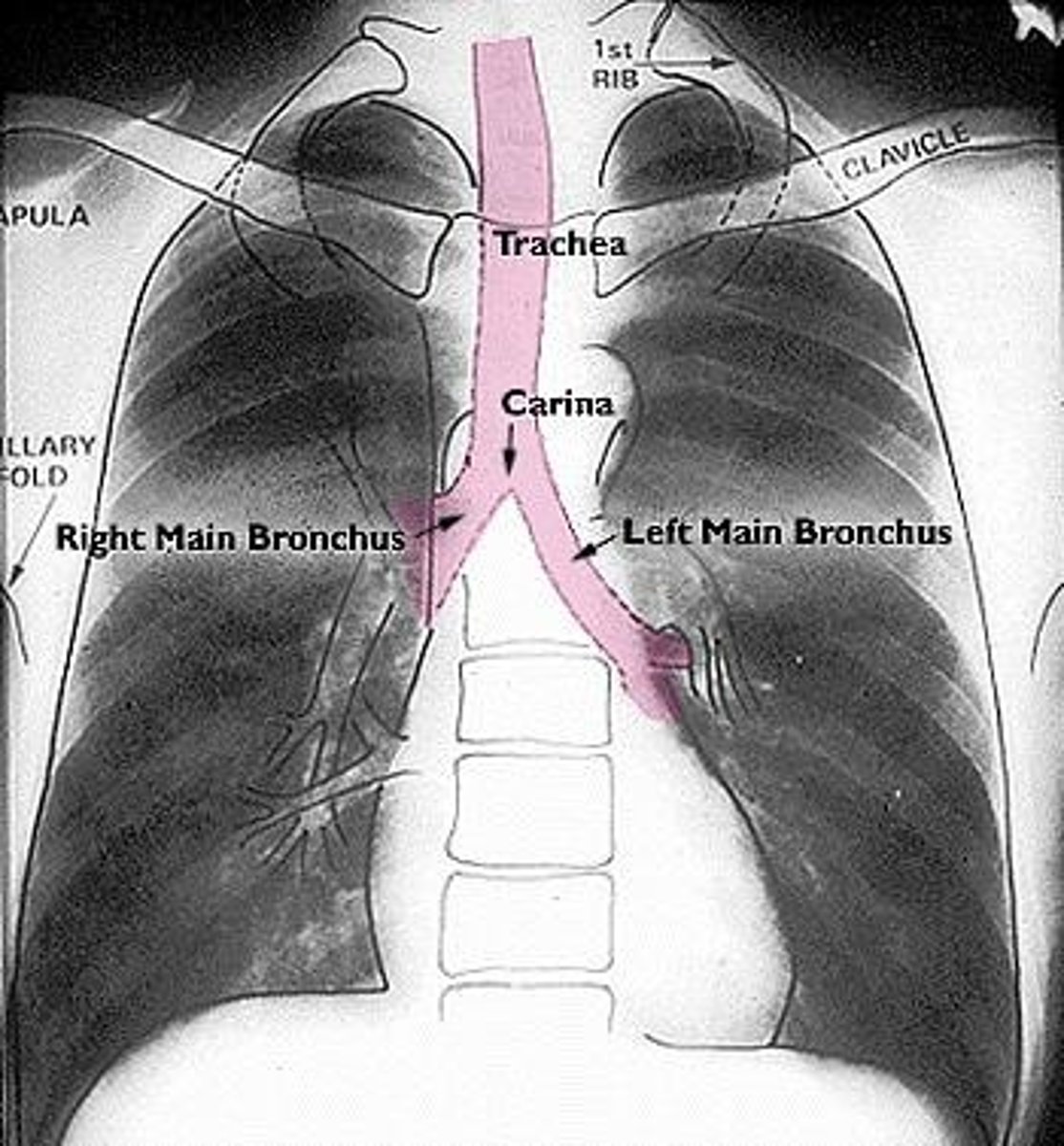 <p>The bifurcation of the trachea at T4-T5.</p>