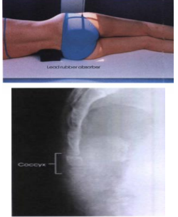 <p><span><strong>PP: </strong>Lateral recumbent; interiliac plane <strong>┴ </strong>to IR; pelvis &amp; shoulder in true lateral position</span></p><p><span><strong>RP</strong>: 3.5 in. posterior &amp; 2 in. inferior to ASIS</span></p><p><span><strong>CR: ┴</strong></span></p><p><span><strong>SS: </strong>Coccyx</span></p>