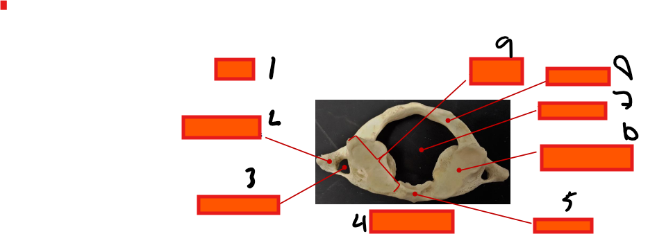 <p>where is the posterior arch?</p>