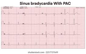 <p>Rhythm Interpretation</p>