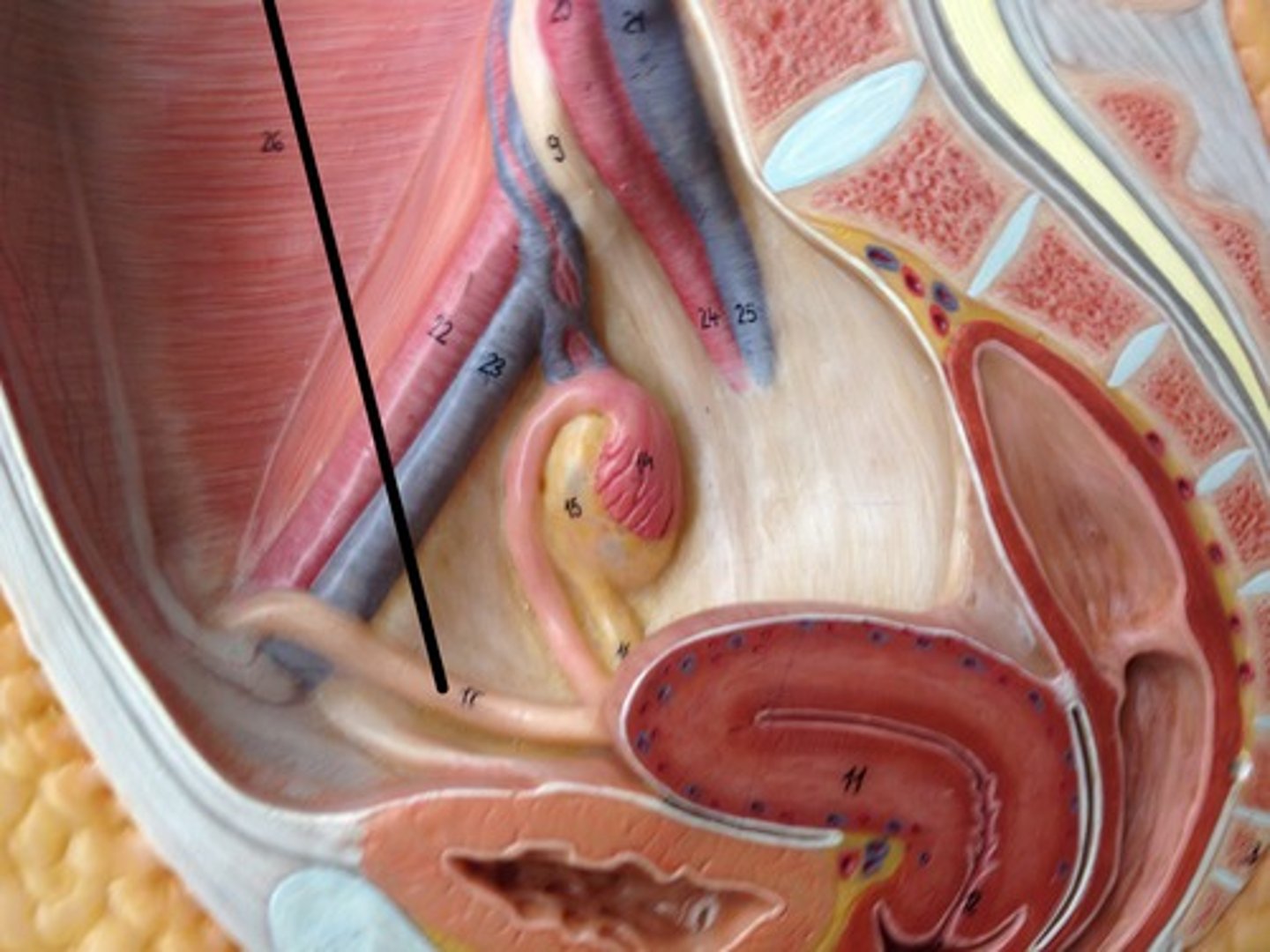 <p>Found in inguinal canal</p><p>Fold over connective tissue</p><p>Indicates tract that ovaries would have taken if they were testes</p><p>Fuses with tissue of the labia majora</p>