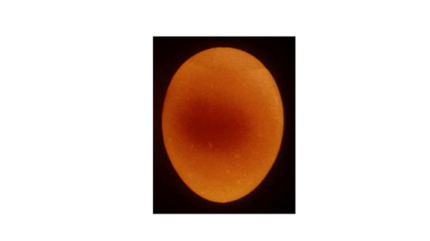 <p>B</p>