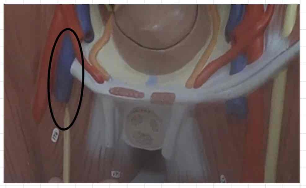 <p>what is this? (torso model)</p>