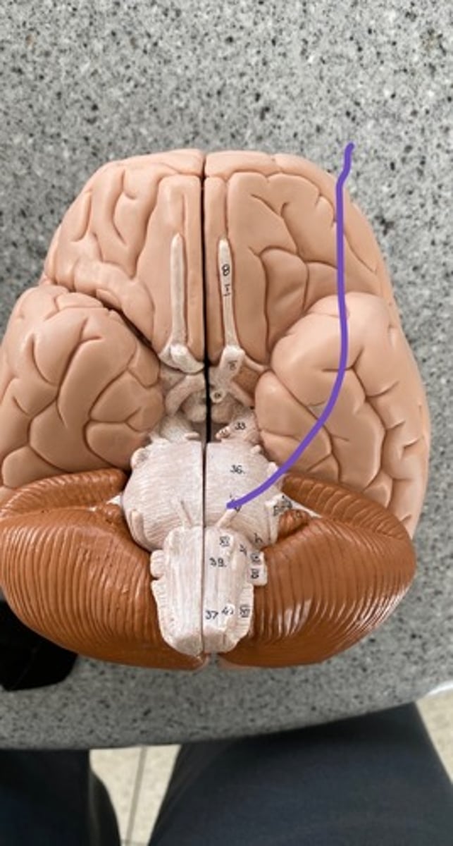 <p>- motor</p><p>- extend from just below pons to lateral rectus muscle of eyeballs.</p><p>- primarily a motor nerve that directs the eyeballs</p>