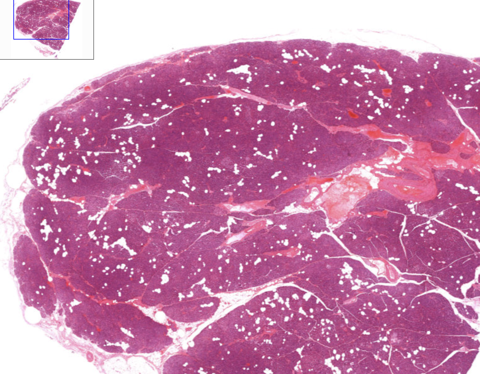 <p>How can you identify the pancreas on a slide?</p>