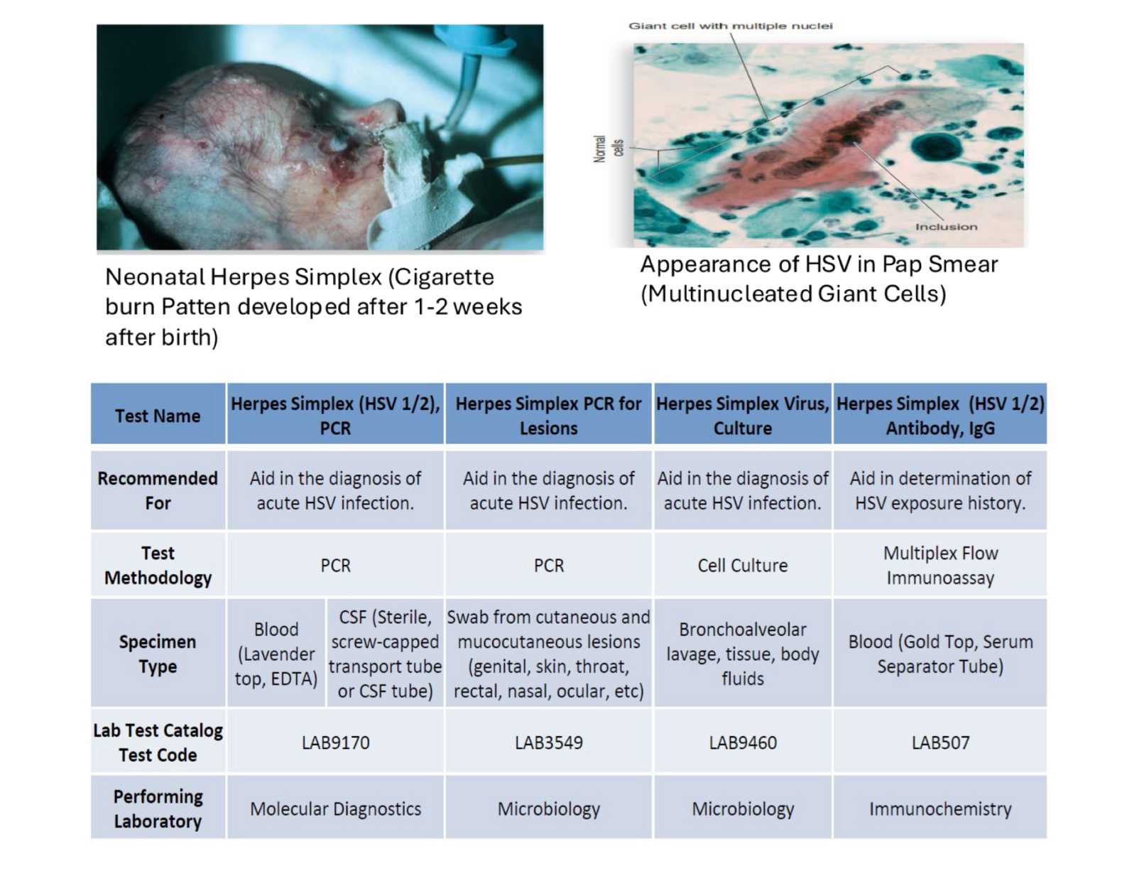 <ul><li><p>scrape of vesicle/genital vesicle fluid/ulcer swab</p></li><li><p>Pap smear</p></li><li><p>Culture: Primary cell cultures </p></li><li><p>Serology: CFT, TORCH</p></li></ul><p></p>