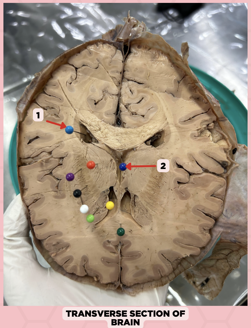 <p>Identify the structure labeled as 2.</p>