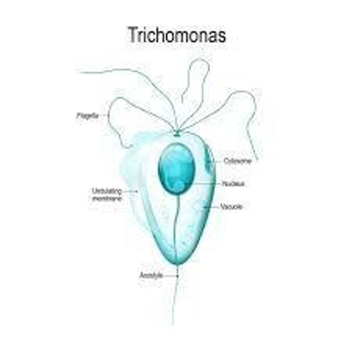 <p>Greenish yellow, frothy vaginal discharge, patchy vaginal rash, irritation, painful urination or intercourse, may be asymptomatic.</p>