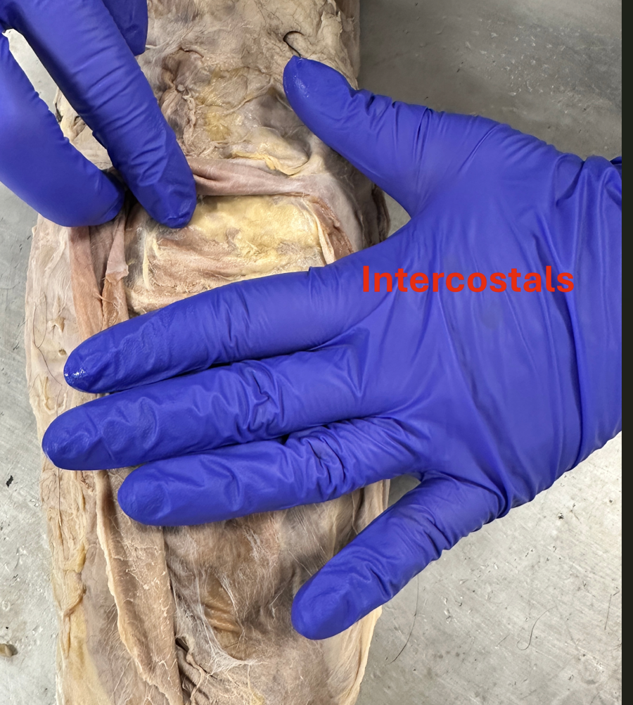 <p>Intercostals (chest muscles)</p>