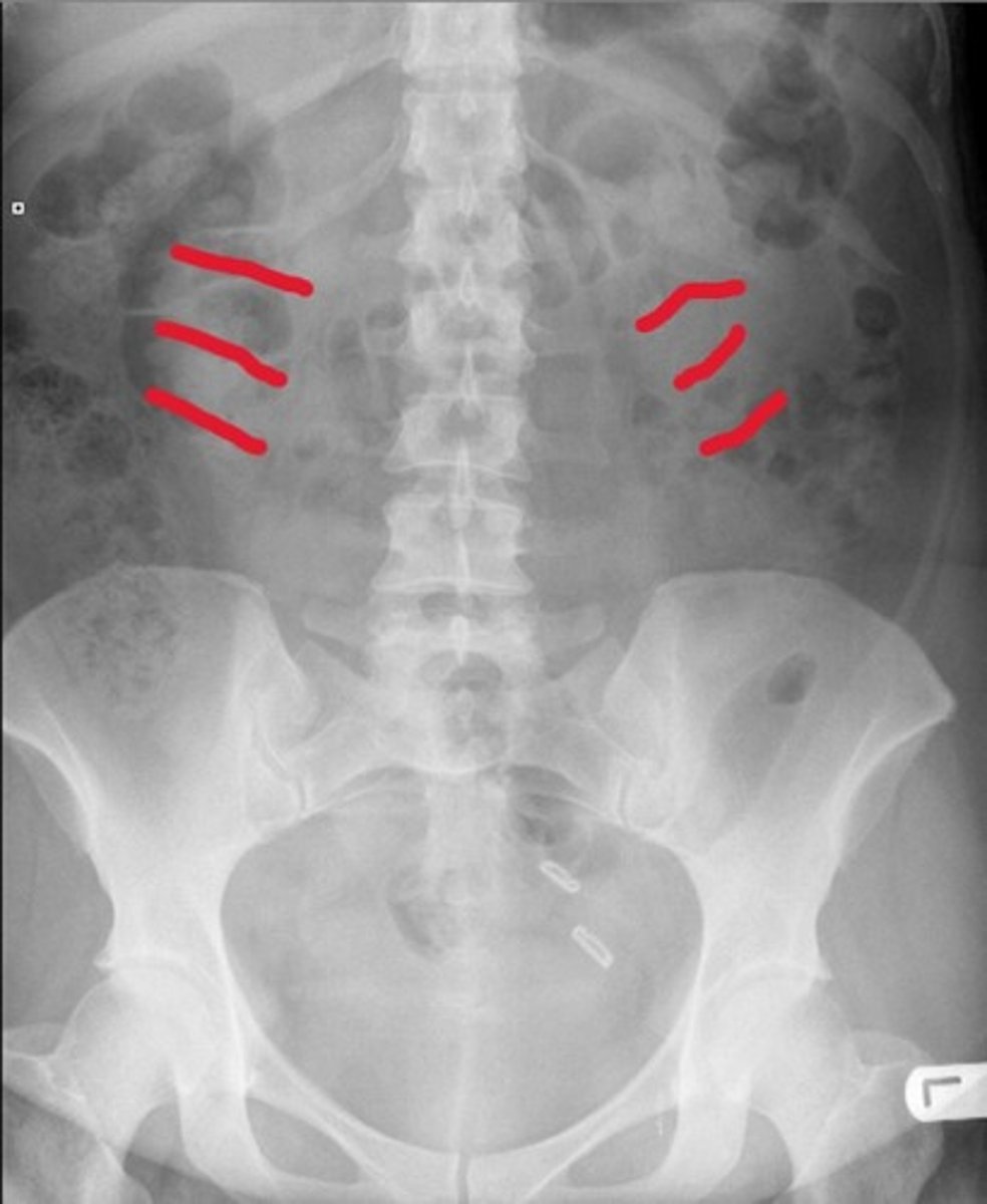 <p>What are the red lines pointing to</p>