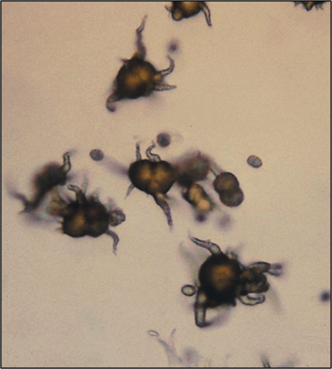 <p>-thorny apple appearance<br>- Yellow-brown, spicule-covered spheres<br>-old specimens<br>-may be associated with the presence of the ammonia produced by urea-splitting bacteria</p>