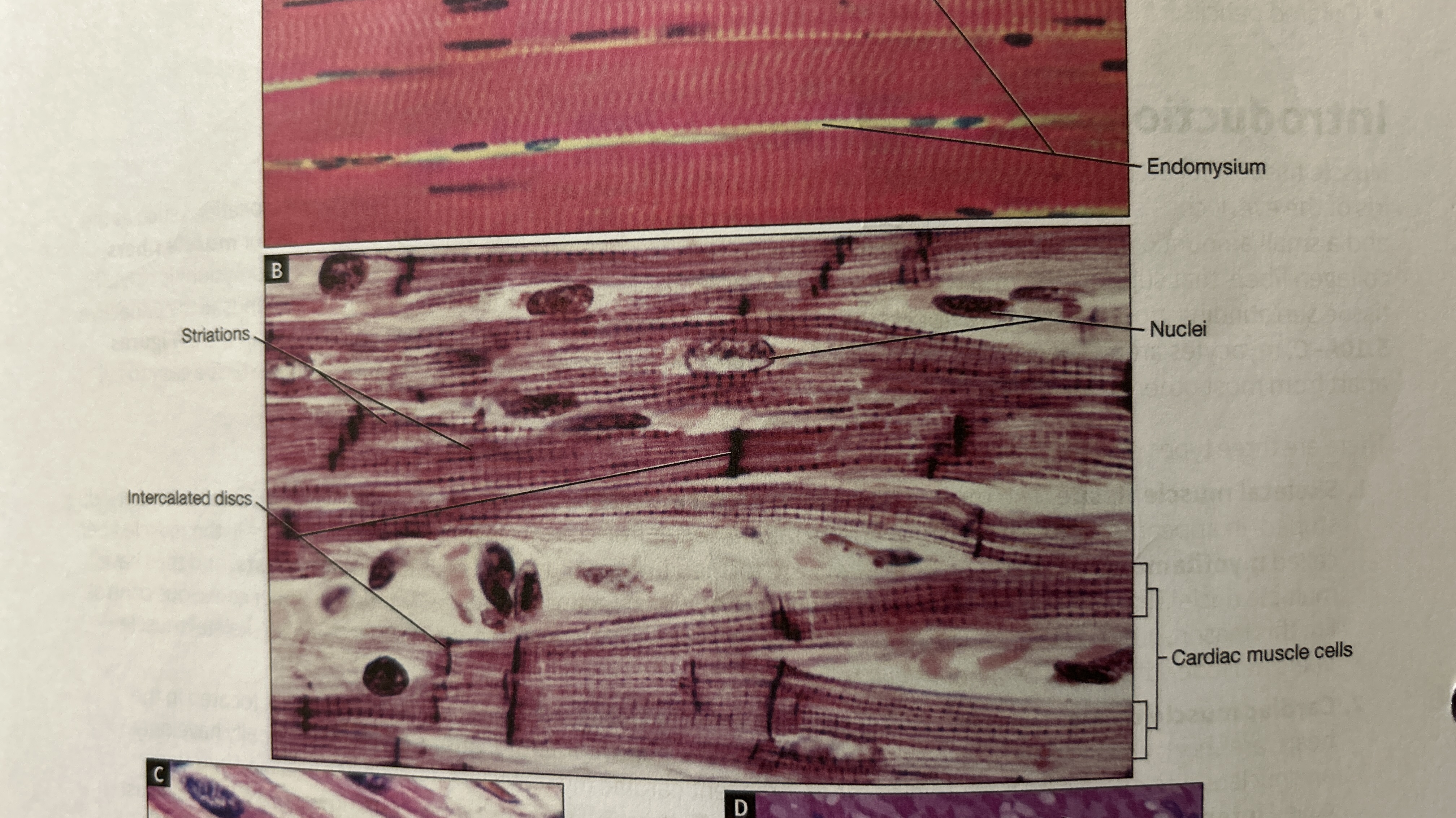 <p>Cardiac Muscle Tissue </p>