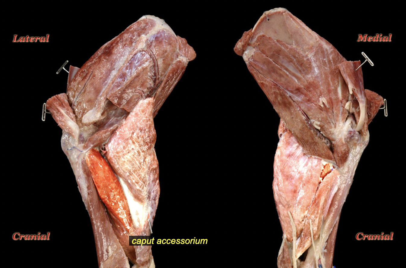 <p>O: neck of humerus<br>I: olecranon<br>A: extension of elbow<br>N: radial n.</p>