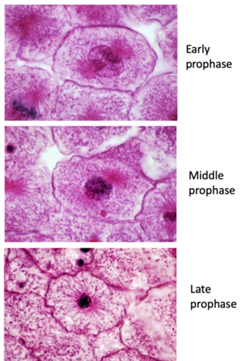 <p>Nucleolus disappears;</p><p>Chromatin condenses;</p><p>Mitotic spindle forms -&gt; Centrosomes migrate to opposed poles</p><p>Nuclear envelope vanishes</p>