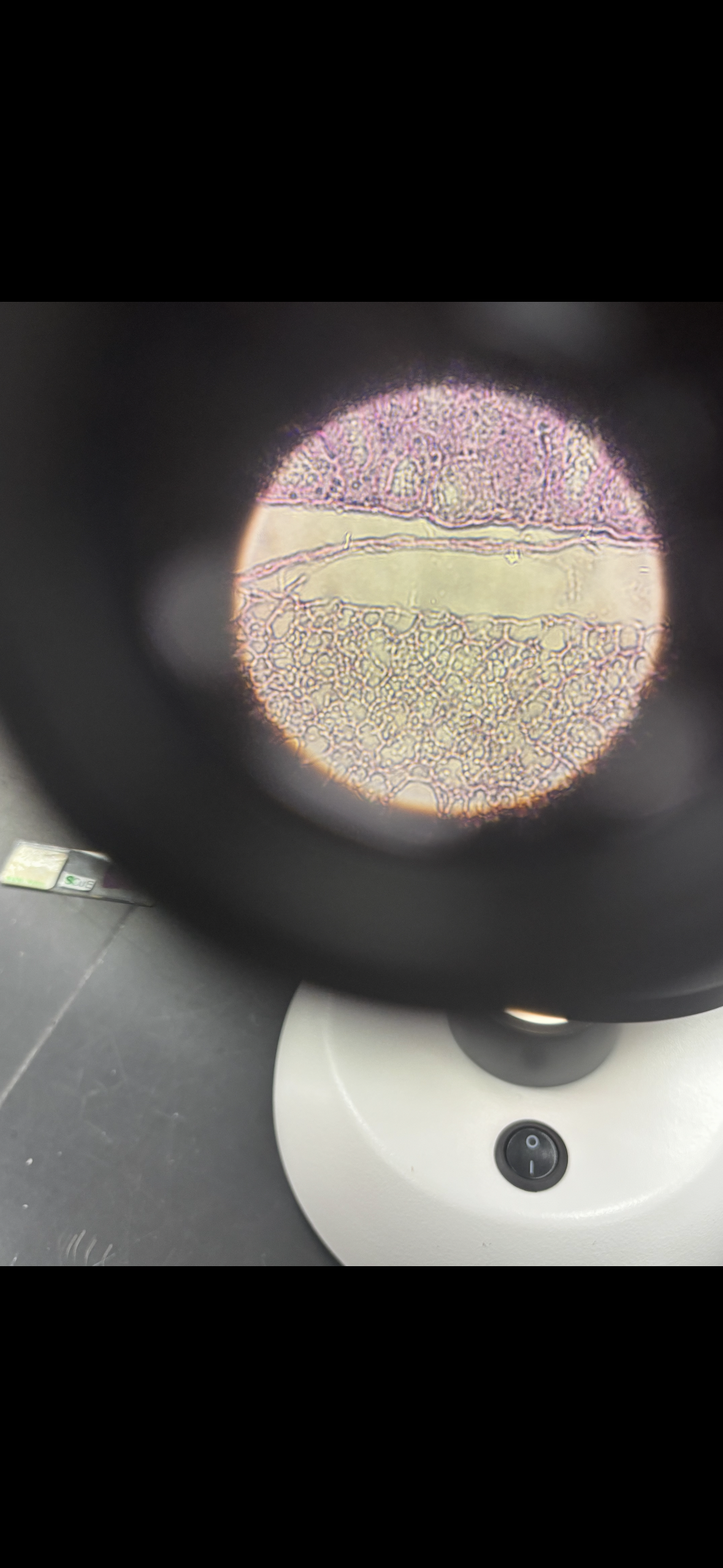 <p>Body location: lining blood vessels</p>