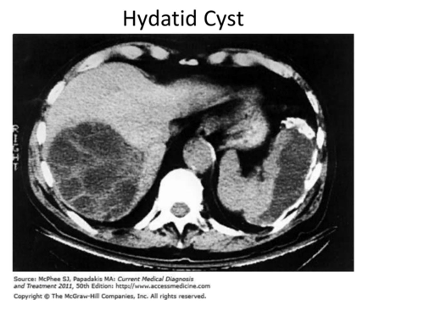 <p>Look for lesions on xray for hyatid cysts/eggs</p>