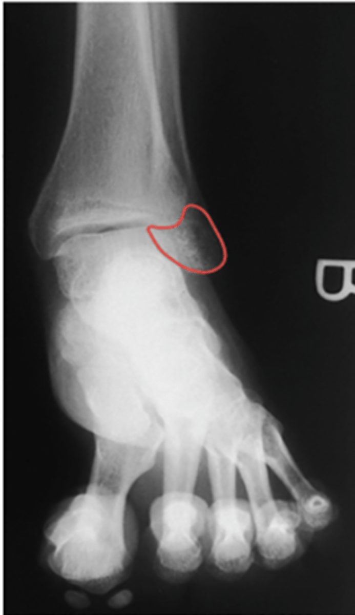 <p>What structure is highlighted?</p>
