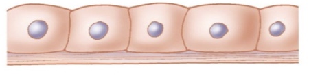 <p>What cellular adaptation is this?</p>
