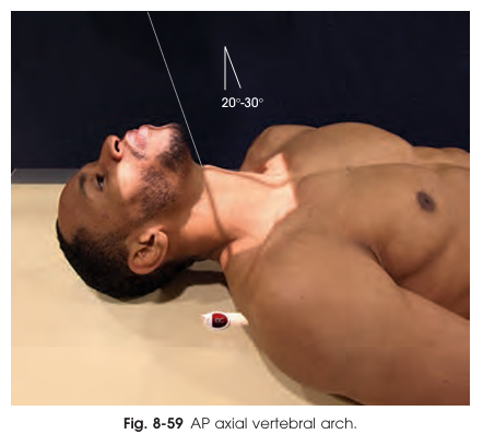<p>CR for AP axial pillar projection</p>
