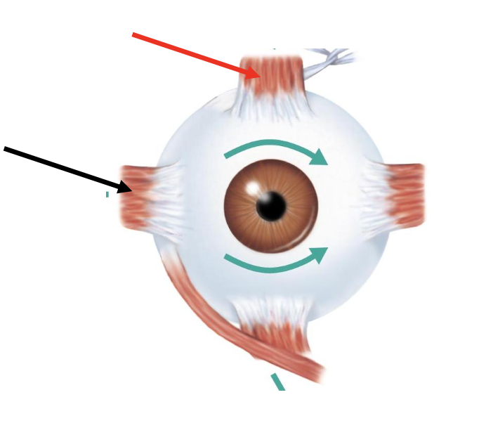 <p>The red arrow is pointing to</p><p></p><p>a. Inferior oblique</p><p>B. Inferior rectus</p><p>C. Superior rectus</p><p>D. Superior oblique</p>