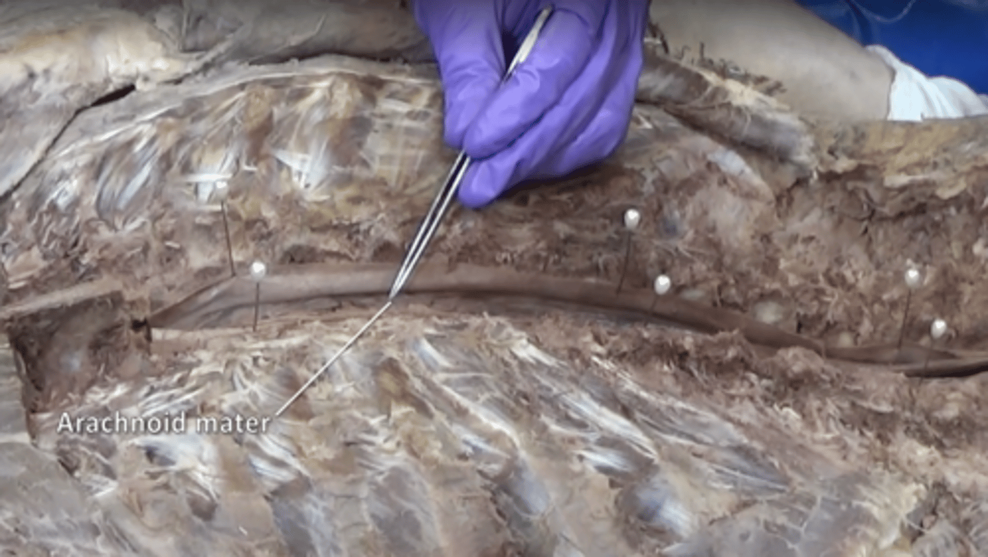 <p>middle layer of the meninges</p>