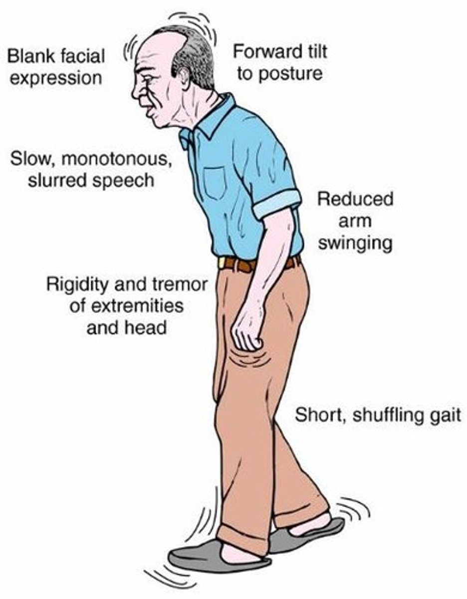 <p>Effects basal nuclei; results in trembling of hands, stiffness in limbs, slow movement, impaired balance, administer drugs that increase dopamine, including anticholinergics and MAO-B inhibitors; can also use deep brain stimulation</p>