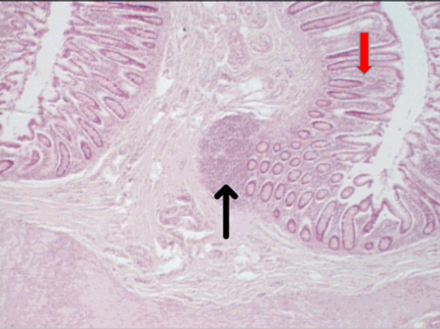 <p>black arrow</p><p>primary lymphatic nodule (made of B lymphocytes)</p>