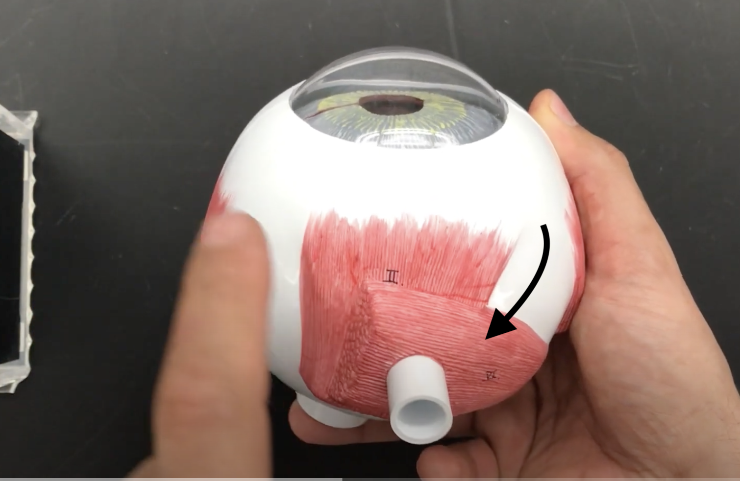 <p>What muscle is this?*****</p>