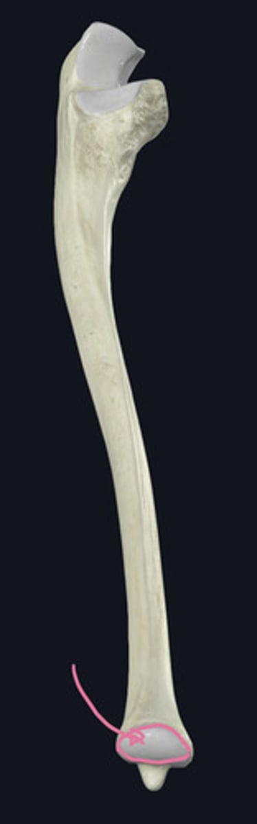 <p>for the ulnar notch of the radius</p>