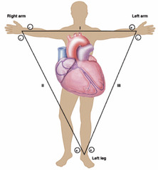 Leads I, II, III
they record impulses that travel from - to + pole

I=records impulses b/t left and right arm
II=records right and left leg
III=records left arm and left leg