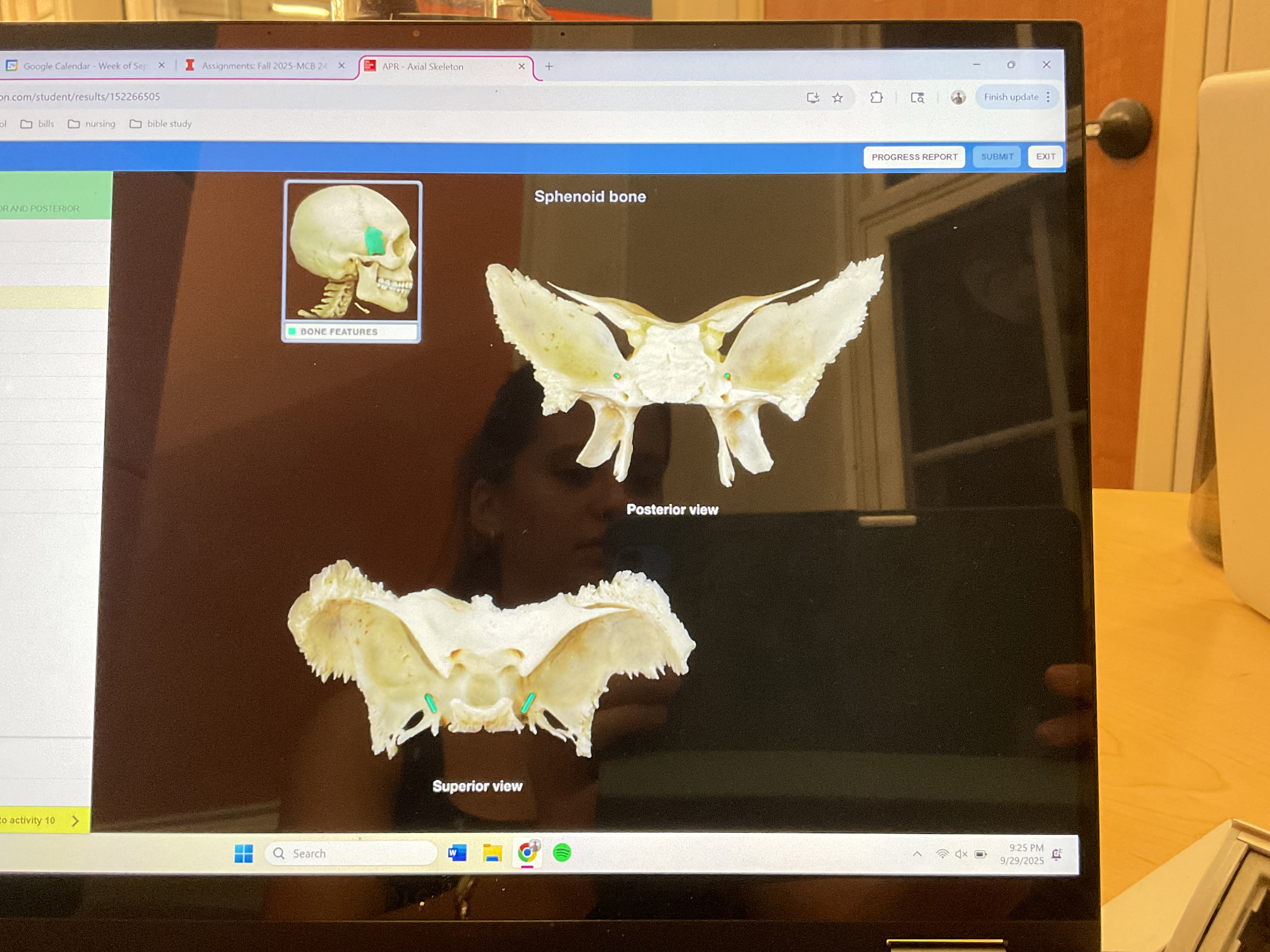 <p>Foramen rotundum</p>