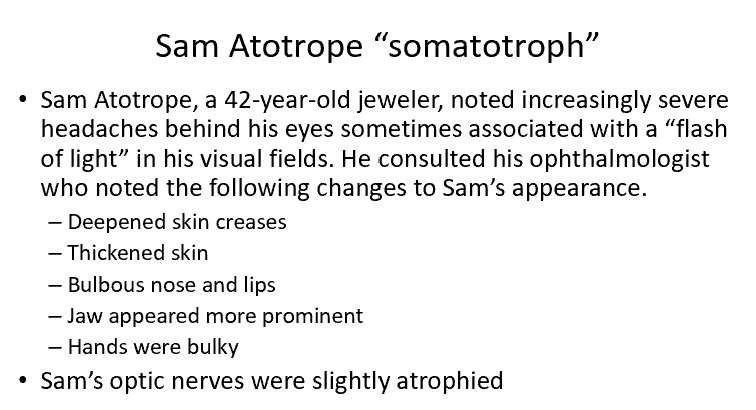 <p>Somatotroph Adenoma Case</p>