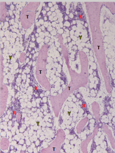 <p>What region of a long bone does this slide show?</p>